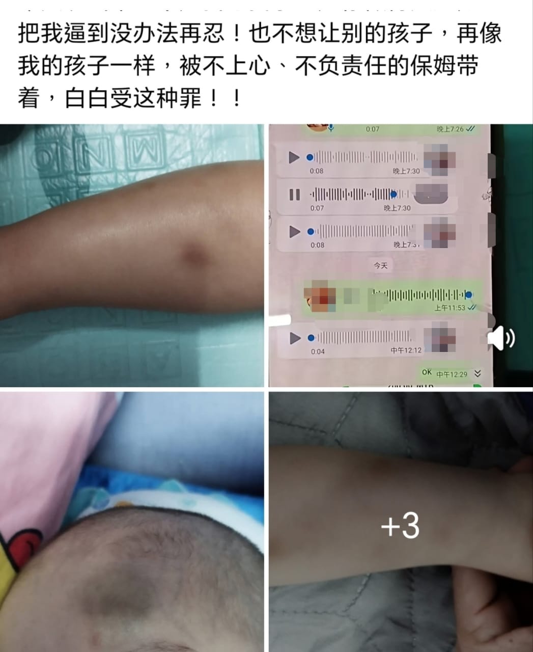 事主透过社交媒体公开事件经过，希望提醒家长关注孩子在托育期间的安全。