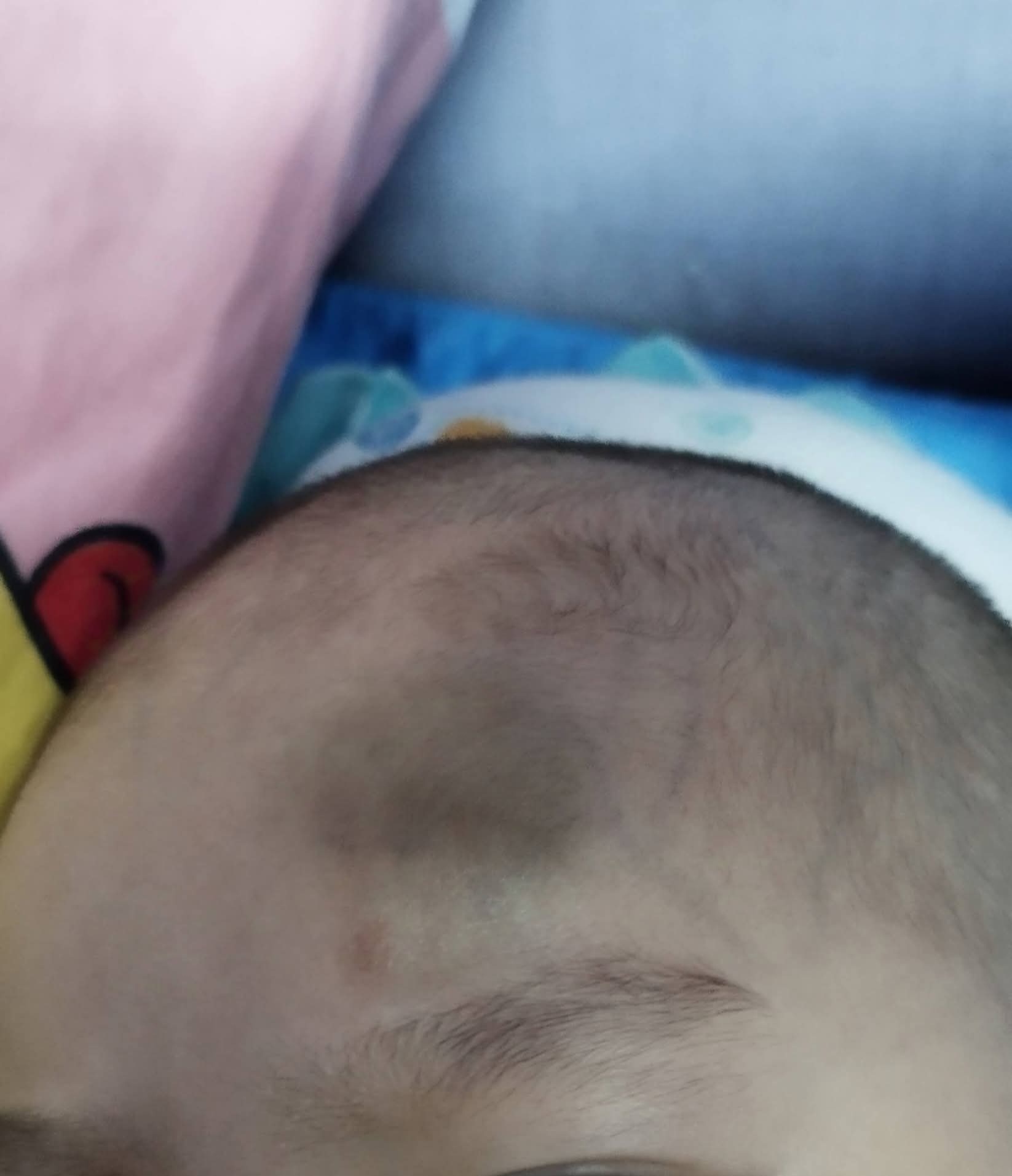 孩子头部曾出现明显肿胀情况，相关照片被母亲公开。